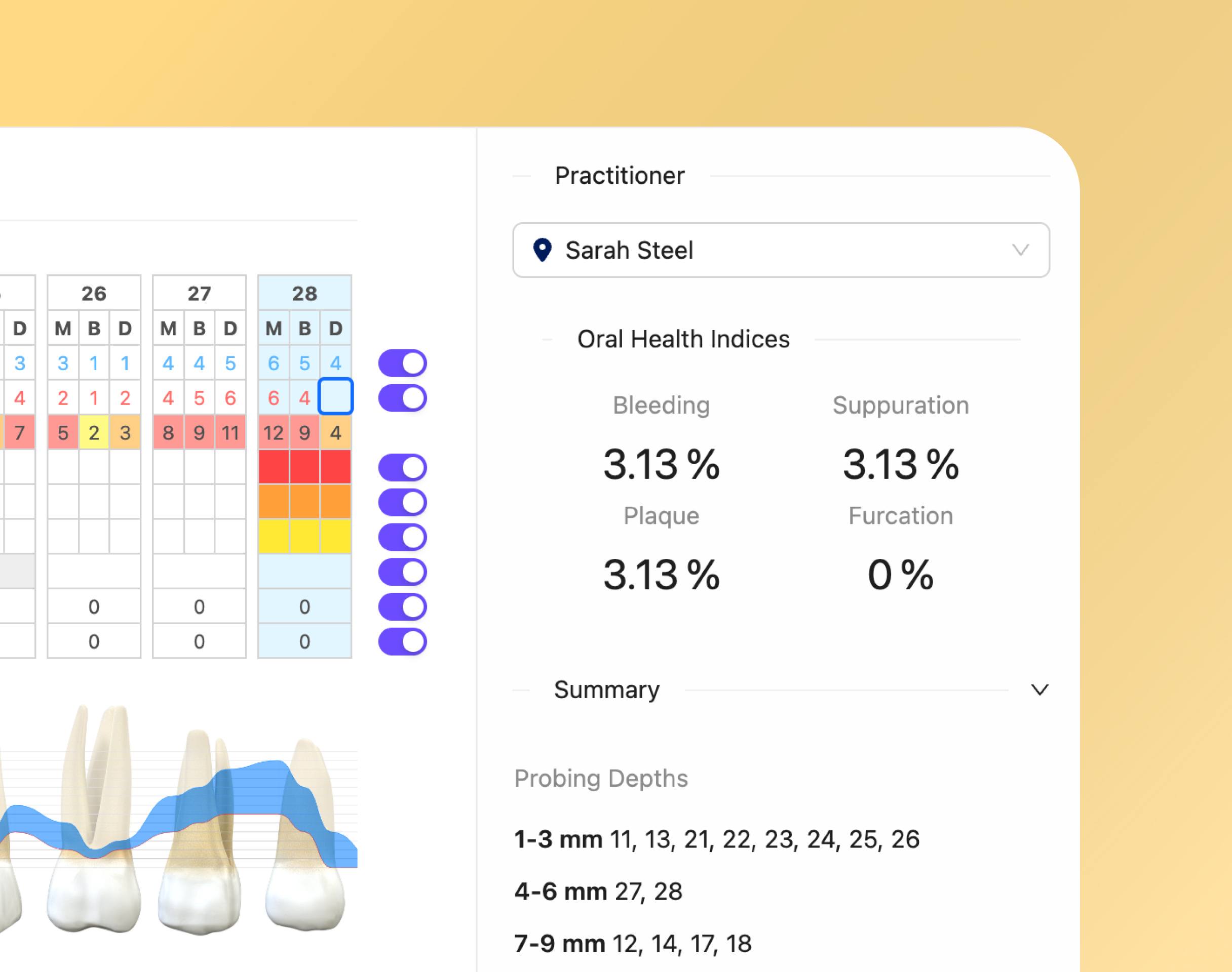 Best-in-Class Perio Charting
