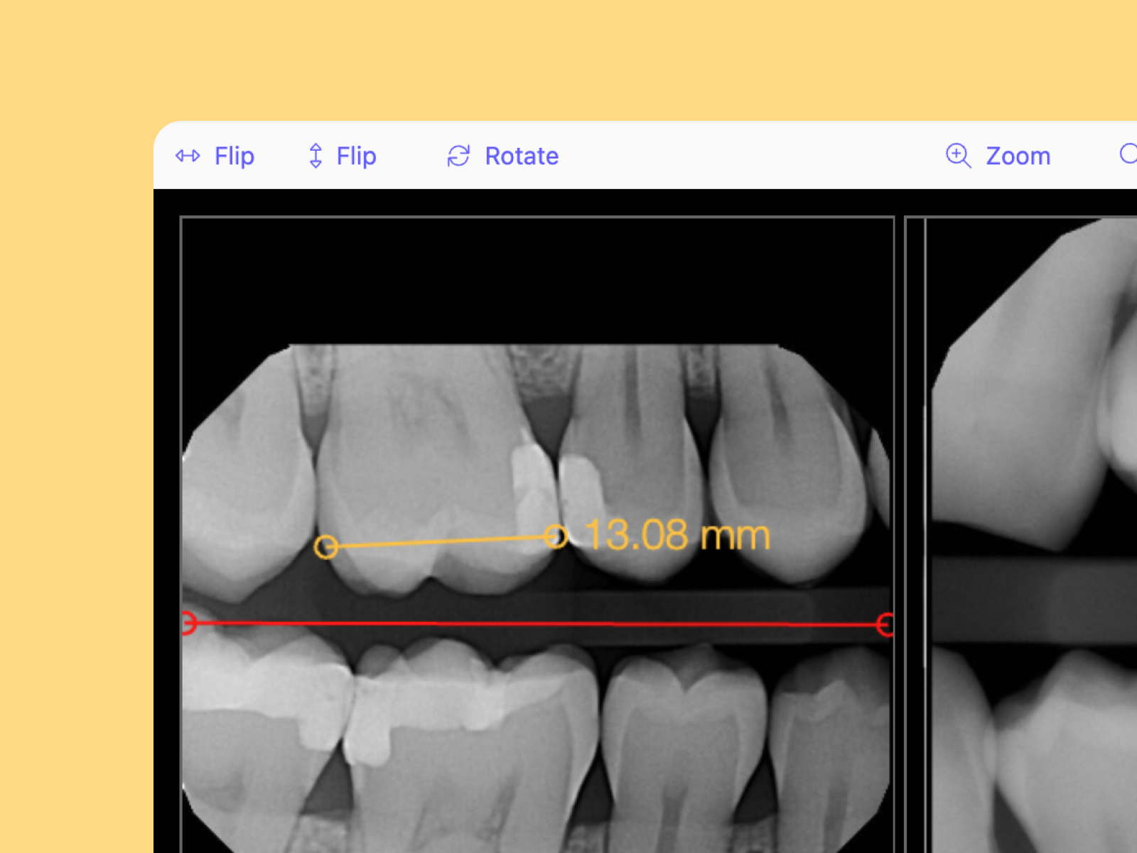 Broad Integration with X-Ray Software